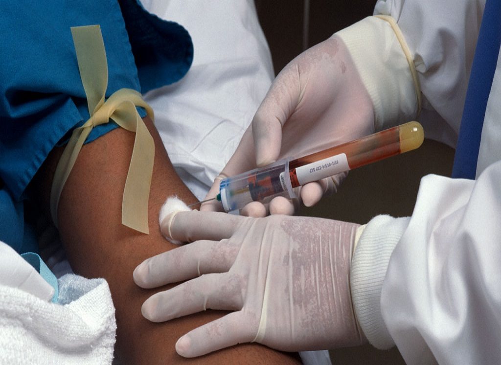 NHS Blood Testing